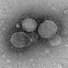 Saudi Arabia Starts Exporting MERS; First Case Reported in US