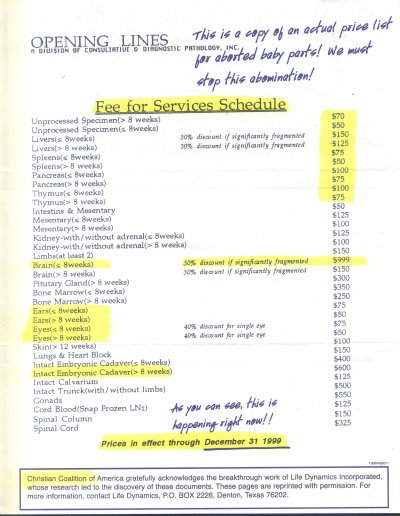 Price List of Various Parts of Aborted Babies