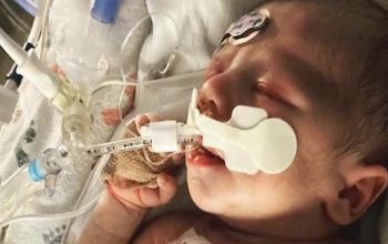 baby Alexander killed with tainted blood transfusion