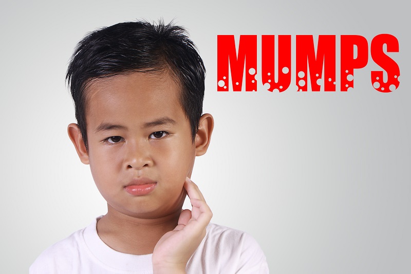 Mumps – An Illness Virologists Wanted Children to Get